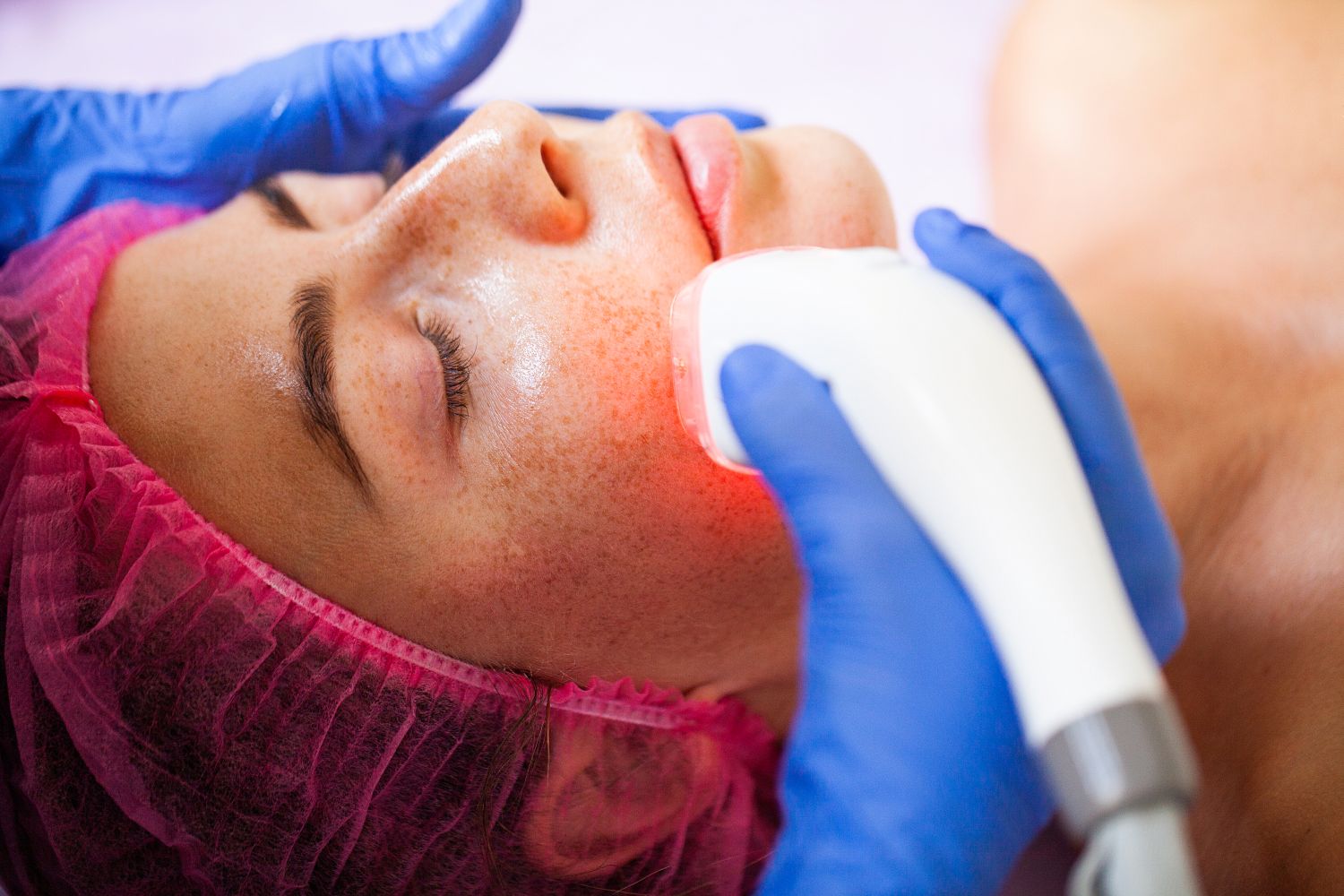เจลหลัง Fractional Laser
